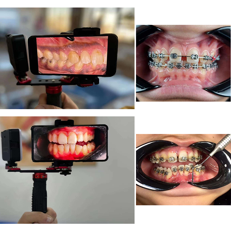 Dentistry Material Mobile Phon – Photography With Mobile Bewertung und Preis